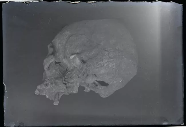 Cráneo humano