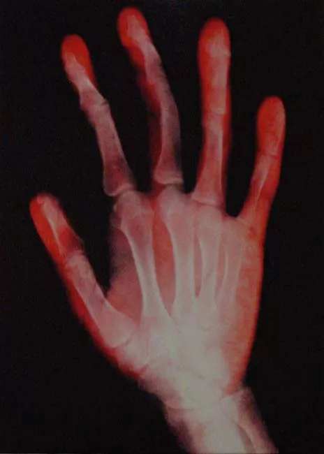 Hands 101