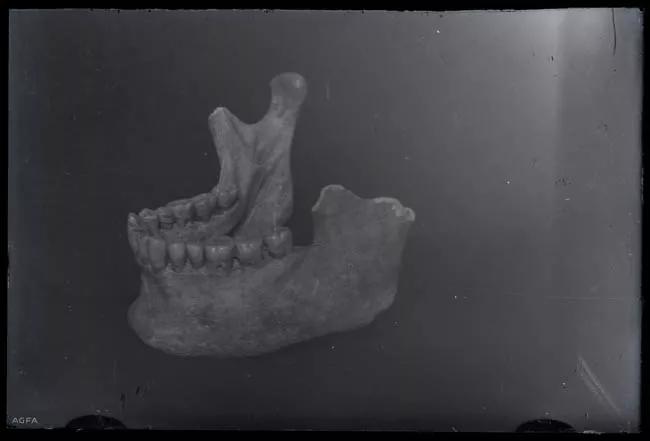 Mandíbula cráneo humano